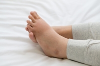 Common Reasons Behind Swollen Feet