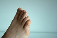 Foot Pain May Be Caused by Corns